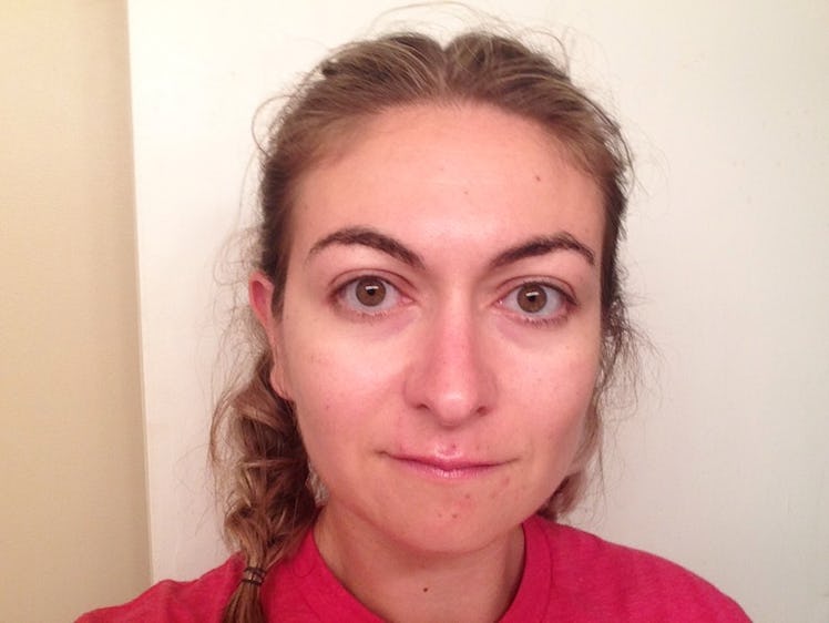 Woman's before photo of a seven-day trial using the snail mucus cream. 