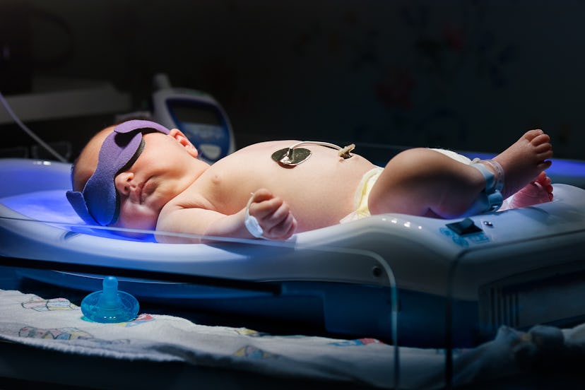 A baby with high bilirubin lying in an incubator with a blindfold on 