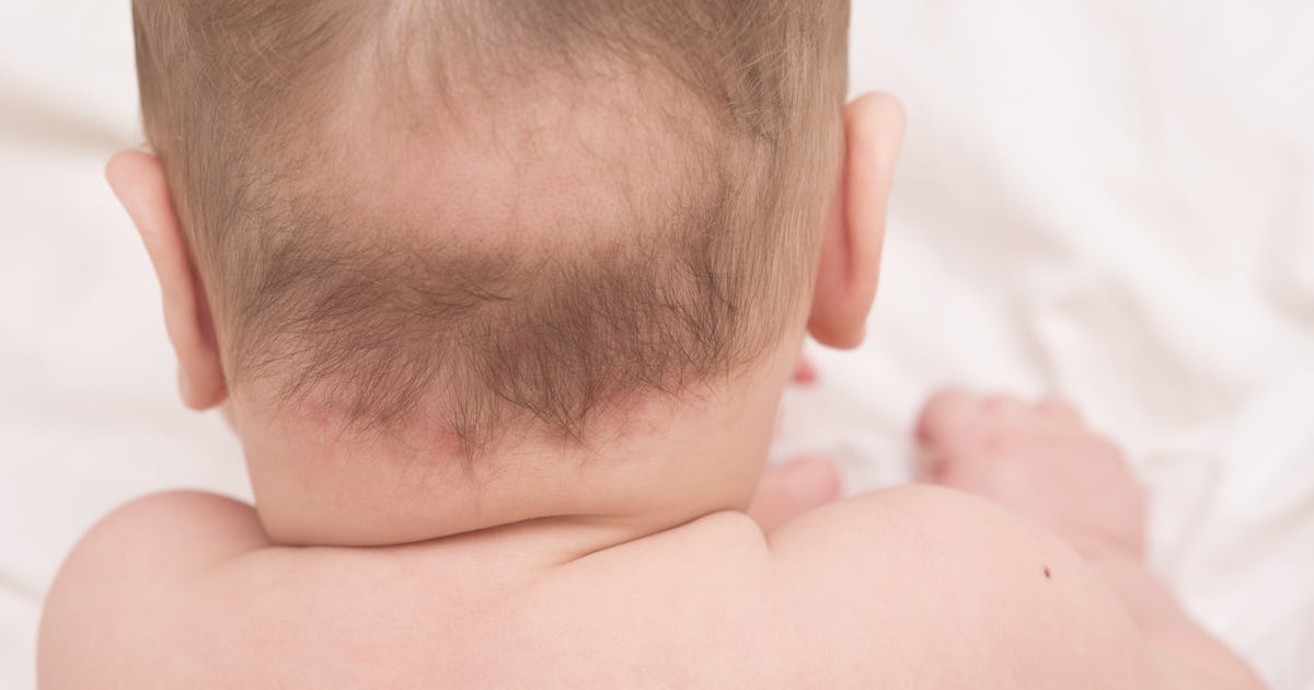Why Does My Baby Have A Bald Spot On The Back Of Their Head It S A Pretty Simple Reason Why Does My Baby Have A Bald Spot On The Back Of Their Head It S A Pretty Simple Reason