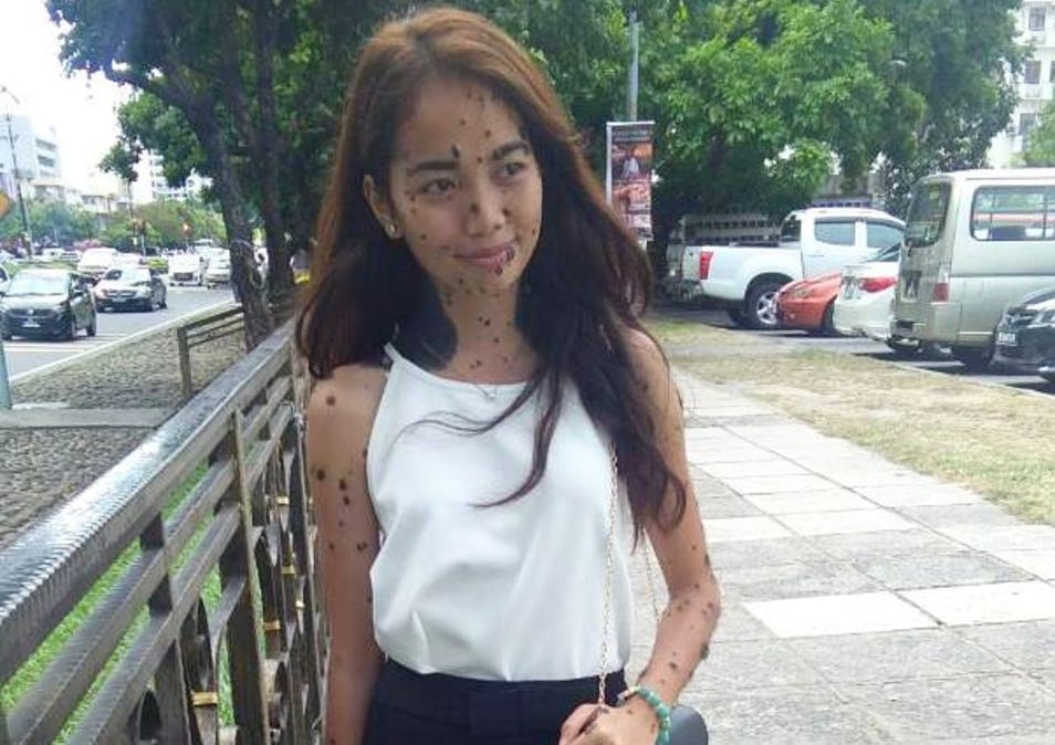 This Miss Universe Malaysia Candidate Is Covered In Moles, But Her