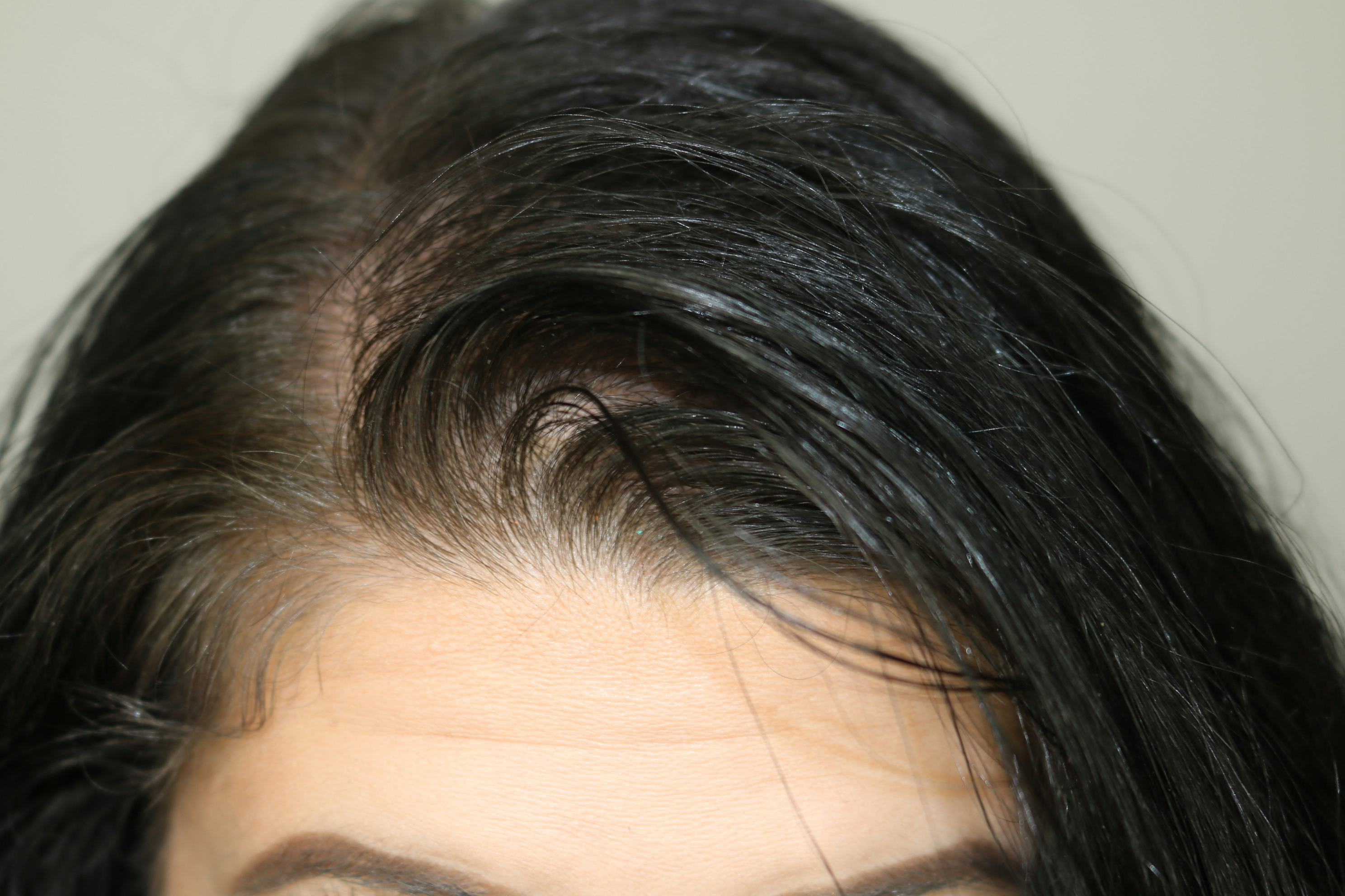 I Used Translucent Setting Powder As Dry Shampoo To Find Out If It