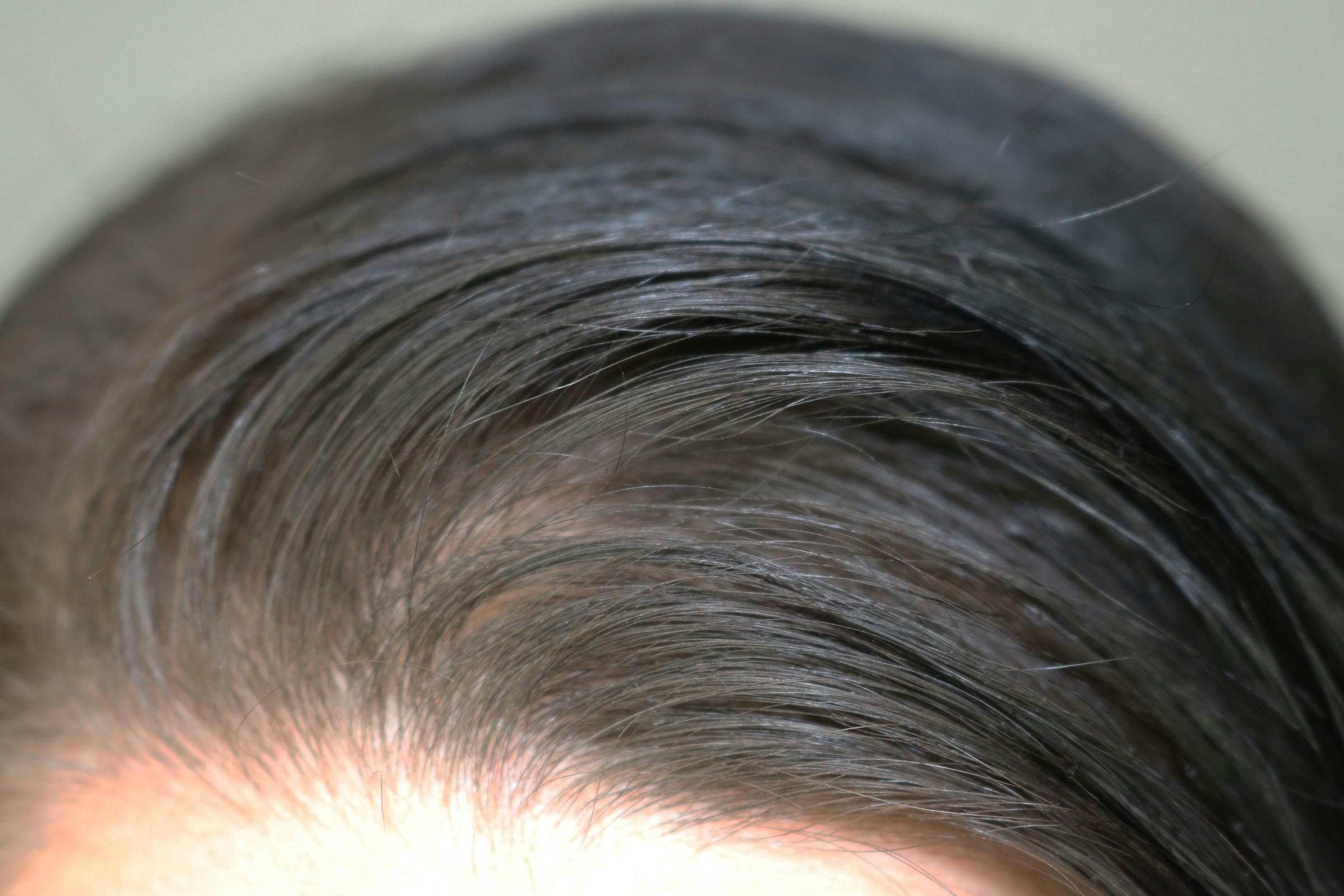 I Used Translucent Setting Powder As Dry Shampoo To Find Out If It