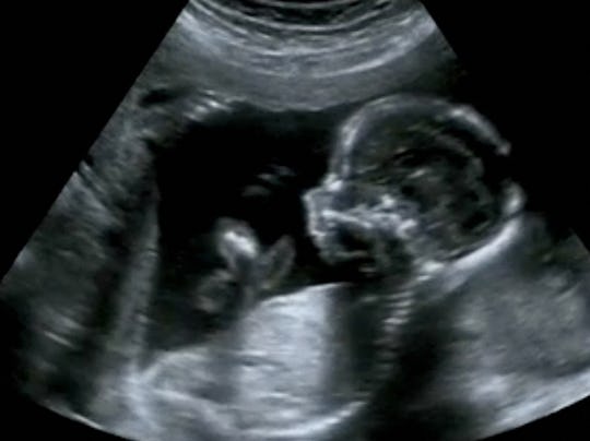 You Won T Believe The 13 Things Your Baby Does In The Womb You Won T Believe The 13 Things Your Baby Does In The Womb