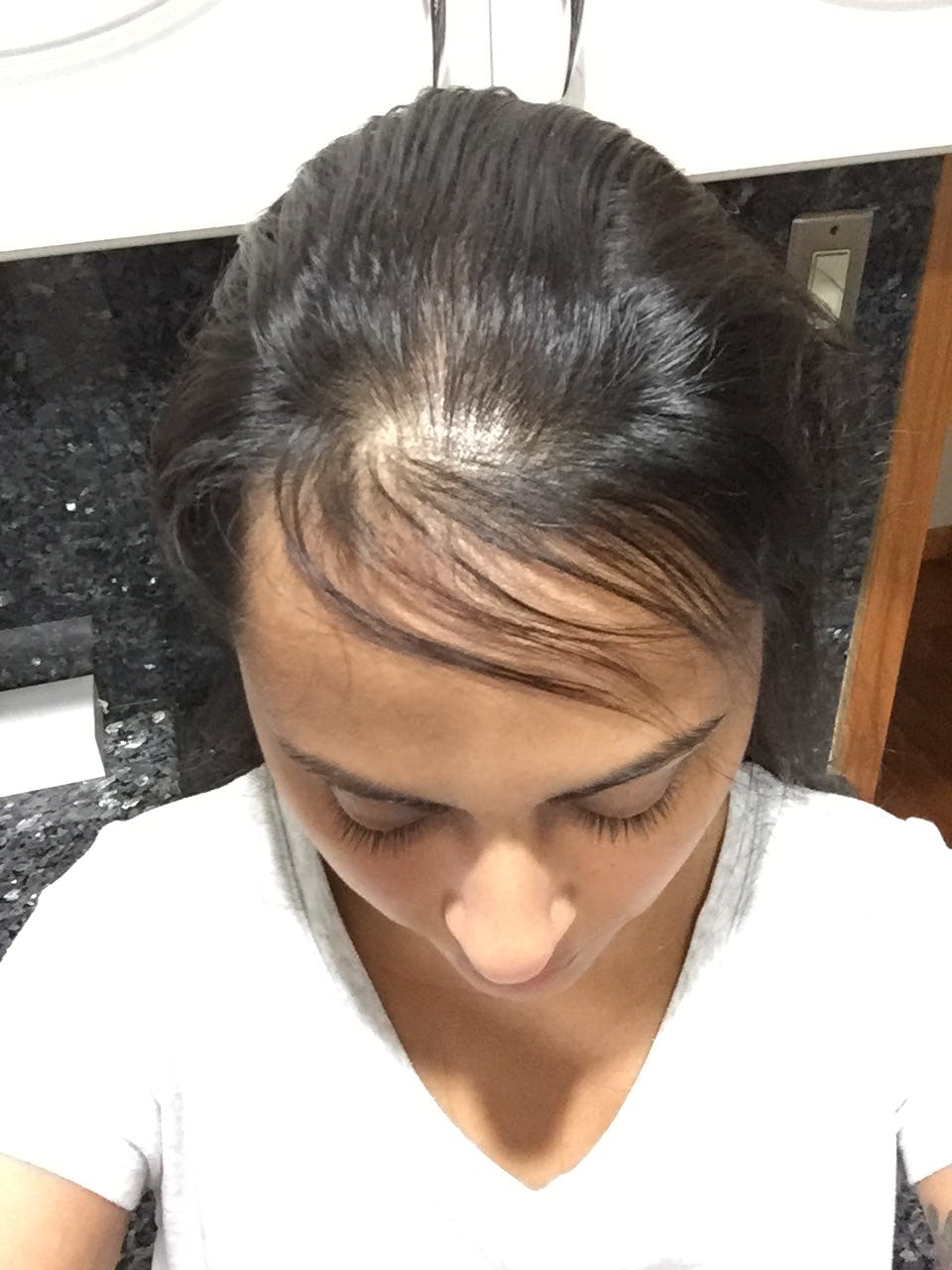 I Tried Gummy Vitamins To Fix My Postpartum Hair Loss & They Were