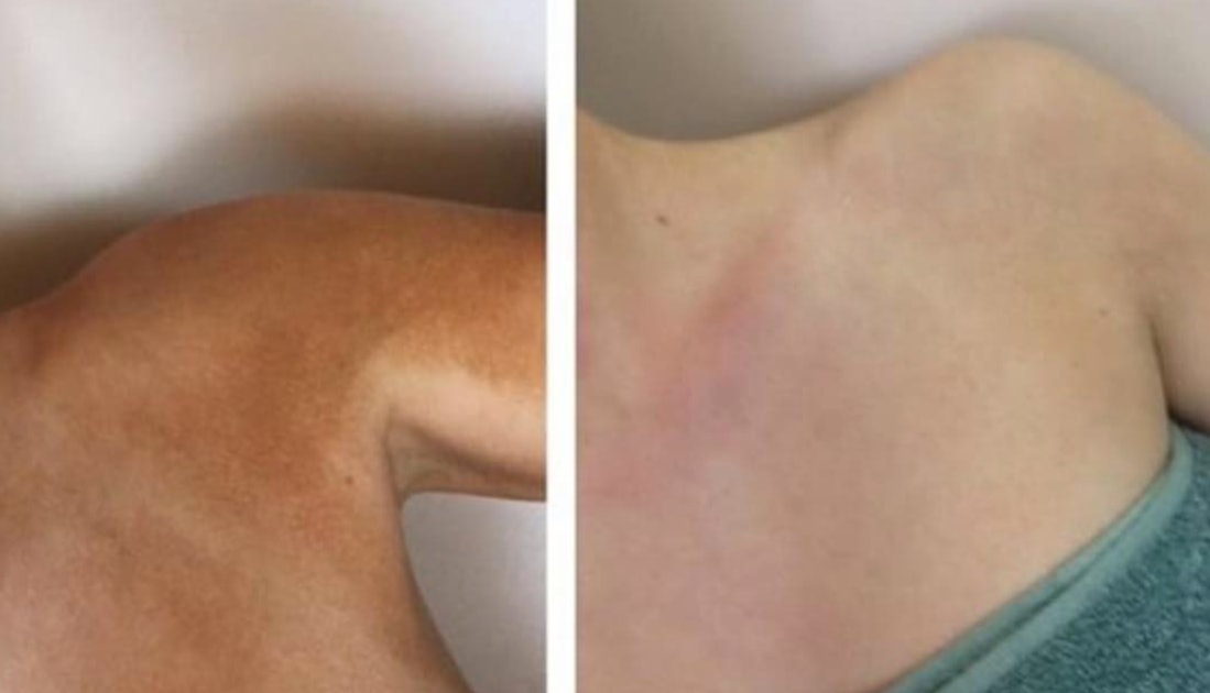 The One Product You Need To Remove Self Tanner Mistakes From Your Body