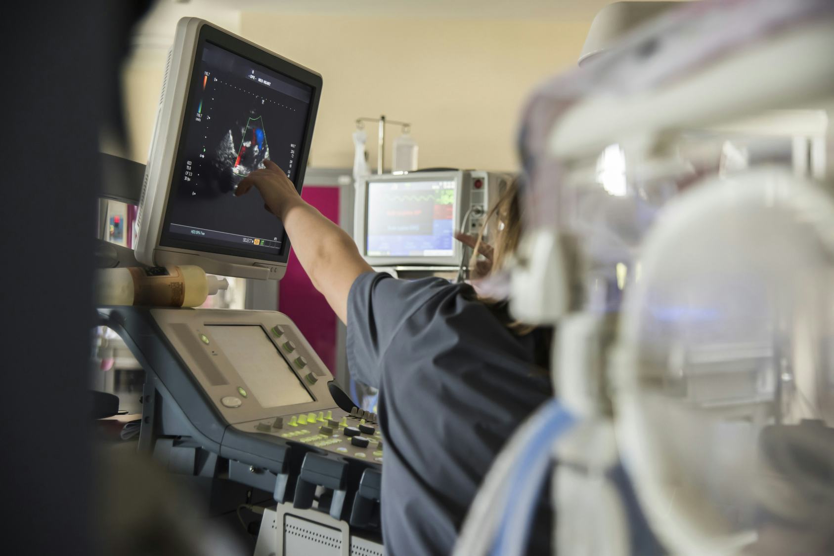 How Long Do Preemie Babies Stay In The Hospital? The Answer Proves How