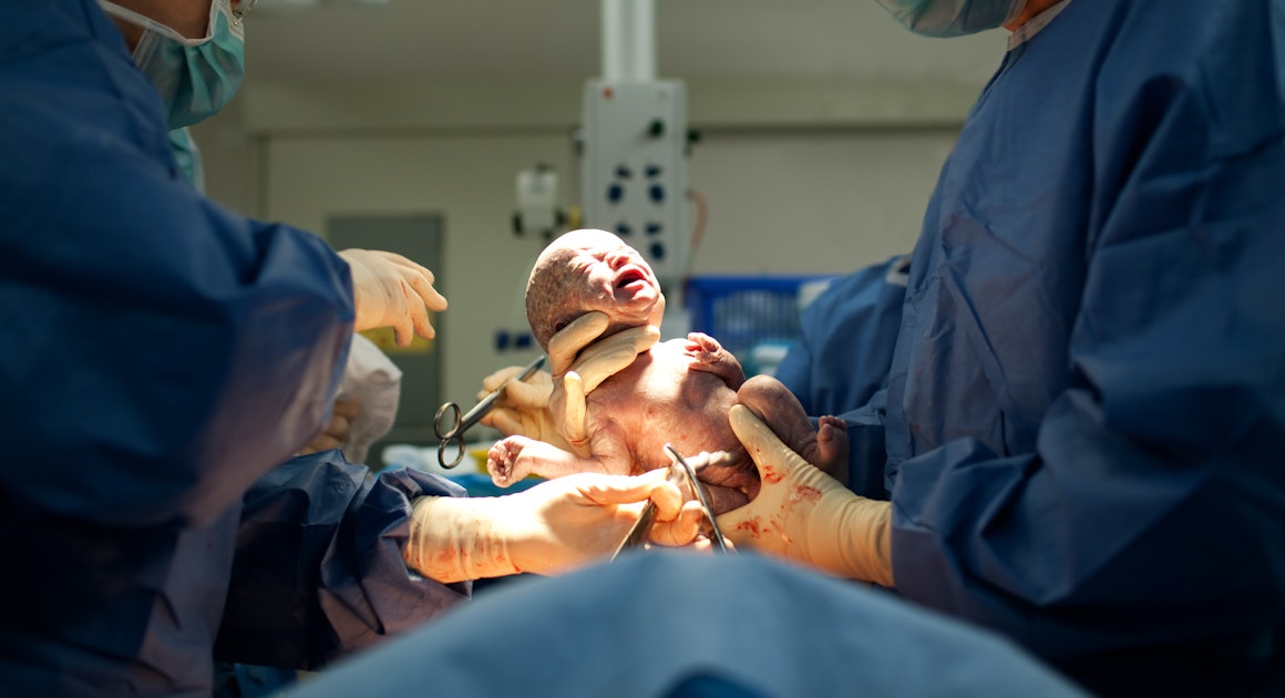 How Long Does A C-Section Take? Experts Break Down The Timeline