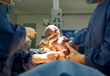 a woman getting a C-section, how long does a C-section take