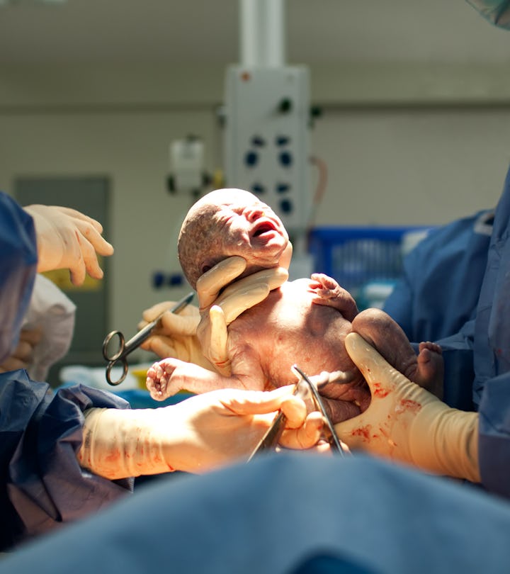 How Long Does A C-Section Take? Experts Break Down The Timeline