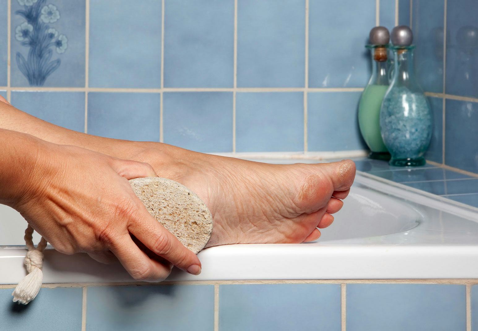 The 4 Best Callus Removers