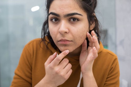 Here's how to tell if your acne is a sign of a bigger health issue.