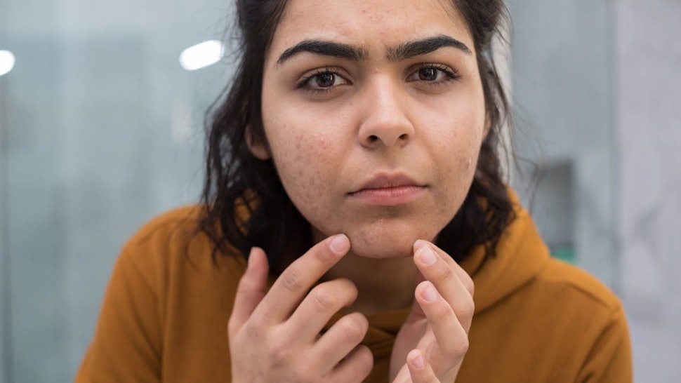 What Causes Female Chin Hair What It Could Tell You About Your