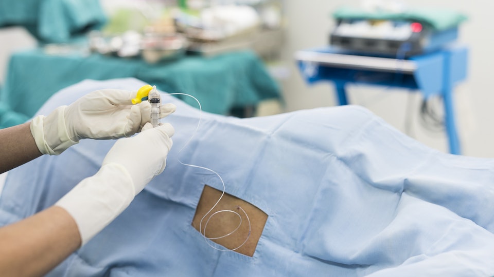 What Does It Mean If An Epidural Only Works On One Side Of Your ... What Does It Mean If An Epidural Only Works On One Side Of Your ...