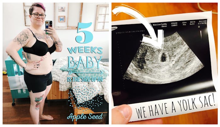 A pregnant woman standing in a bra and black underwear before her ultrasound and the Yolk Sac ultras...