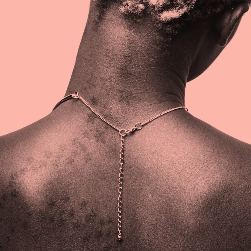 A back of a black woman who lost her hair during a cancer treatment 