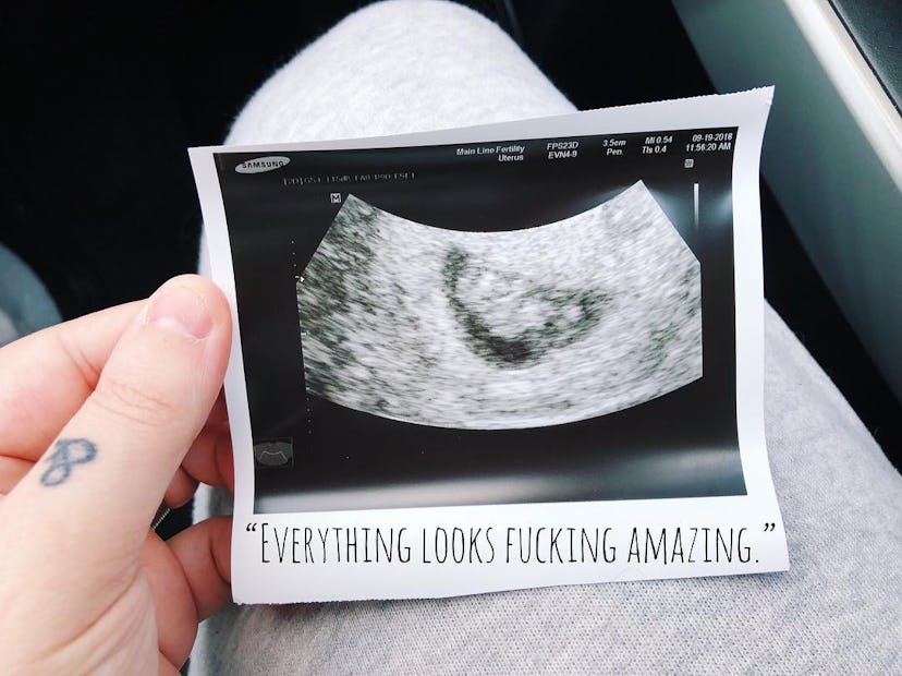 Dese'Rae L. Stage holding an ultra-sound image with the text 'Everything looks fucking amazing.'