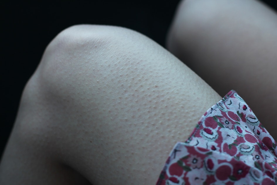 Why You Get Goosebumps When You're Scared? These 3 Studies Explain Link