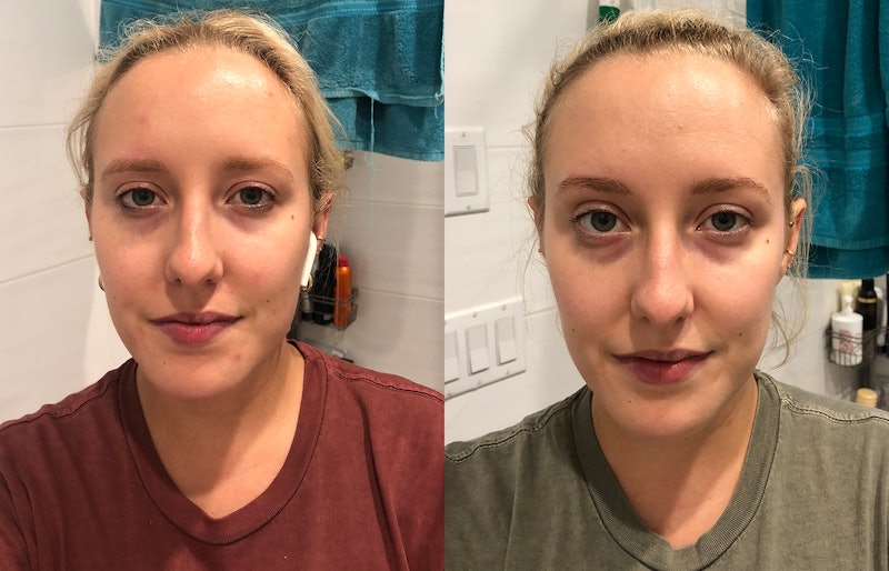Kara McGrath before and after her drastic skin change after taking beauty vitamins for a month