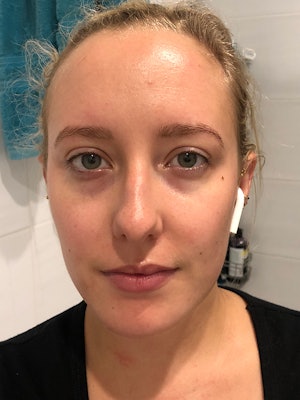 I Took A Complete's Beauty Concentrate Supplement For 30 Days & My Skin ...