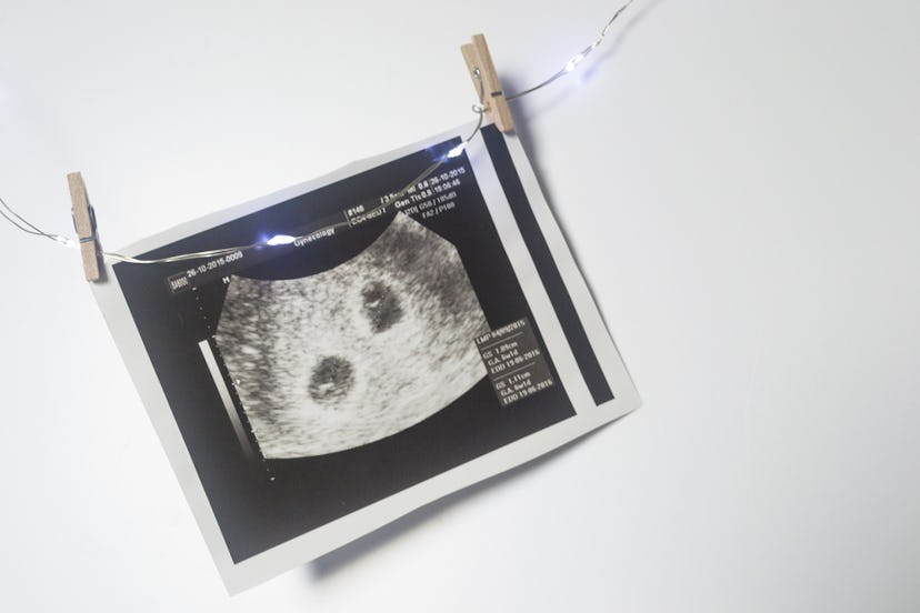 Sonogram image of twins in utero