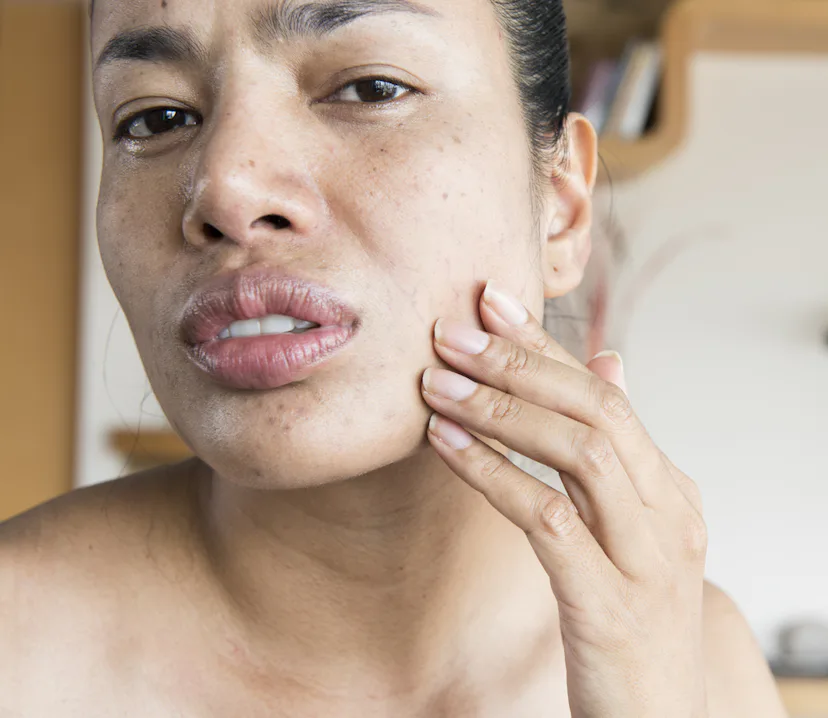 15 Subtle Changes To Your Face That Can Be A Sign Of A Health Problem