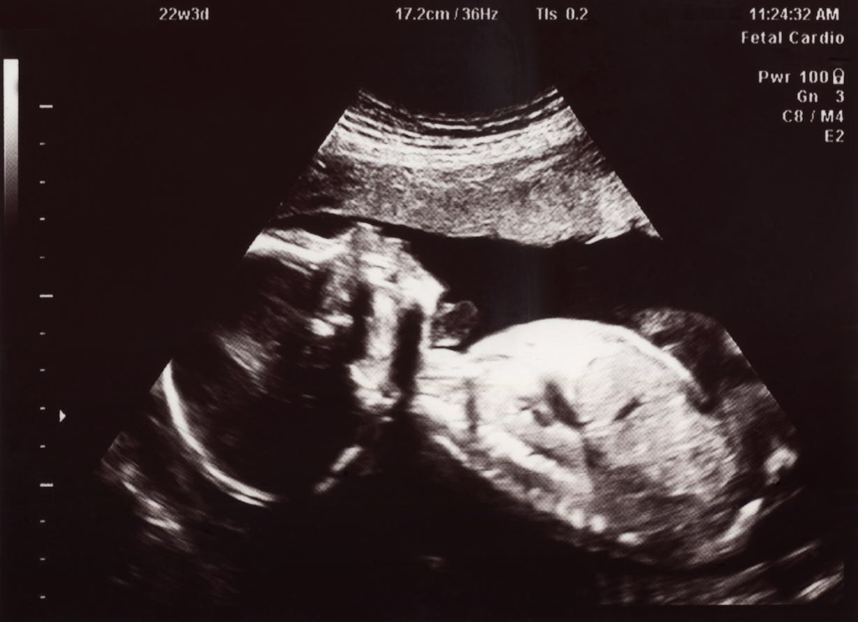 How Can Babies Breathe In Amniotic Fluid? It's Not Like They're Part Fish