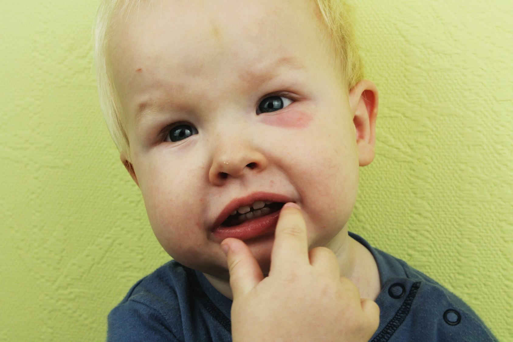 How To Treat A Baby Rash, According To Experts