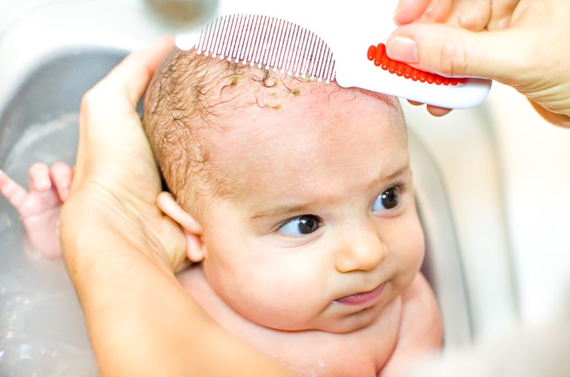 A parent brushing the cradle cap from the head of his baby