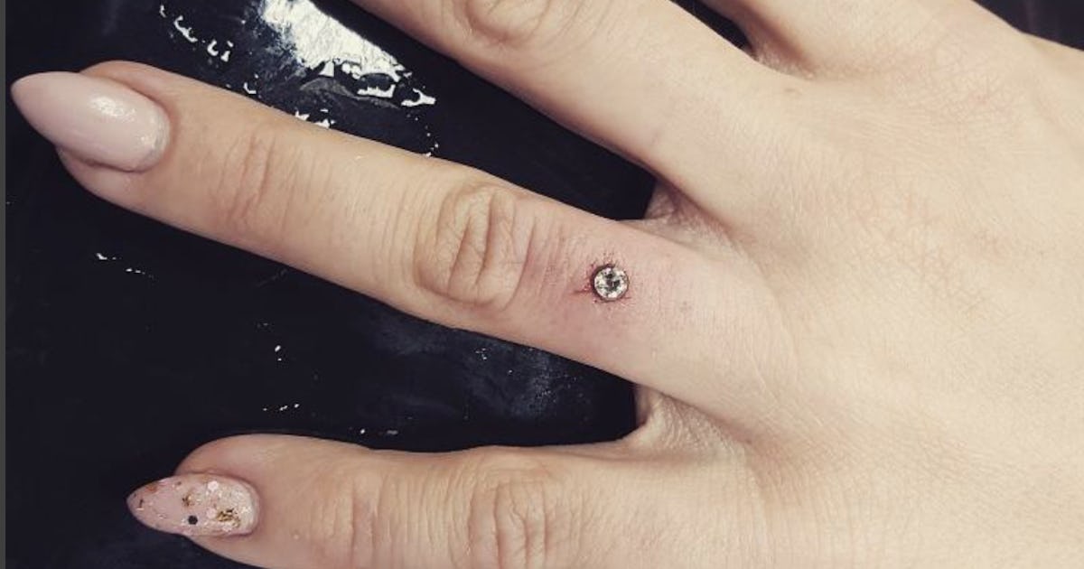 Dermal online anchor finger