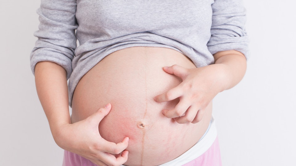 Itching During Pregnancy Means Boy? Here's The Truth Behind That ... Itching During Pregnancy Means Boy? Here's The Truth Behind That ...