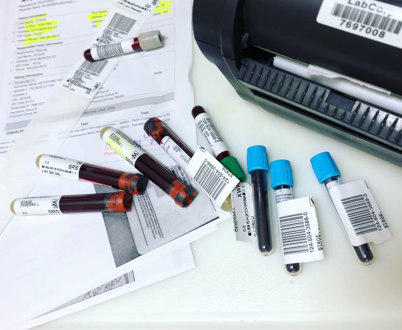 Various vials of blood next to the testing machine and the reports of the blood work next to them