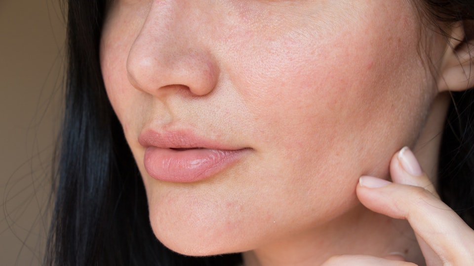 7 Things Your Upper Lip Hair Says About Your Health