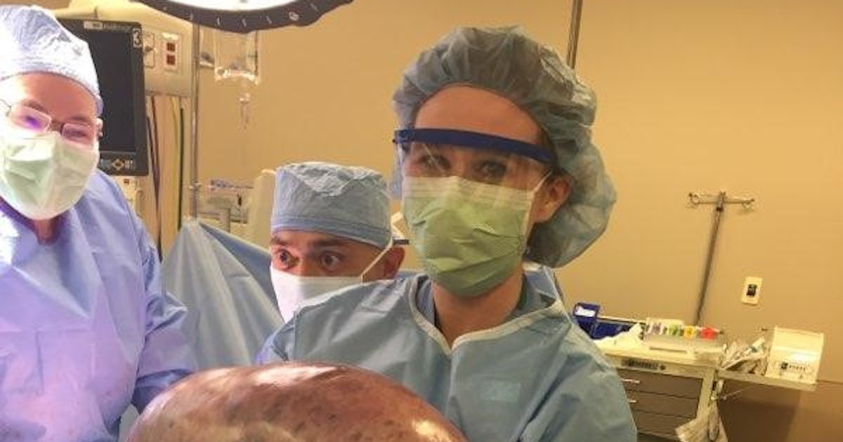 A Woman Had A 50-Lb. Ovarian Cyst Removed & It Was One Of The Largest