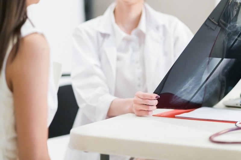 A doctor looking at the scan of a woman diagnosed with breast cancer