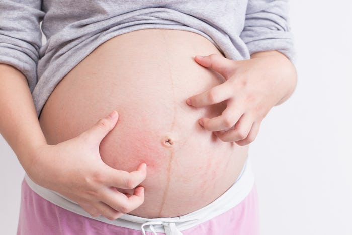 Itching and swelling are two common skin conditions during pregnancy, according to experts.