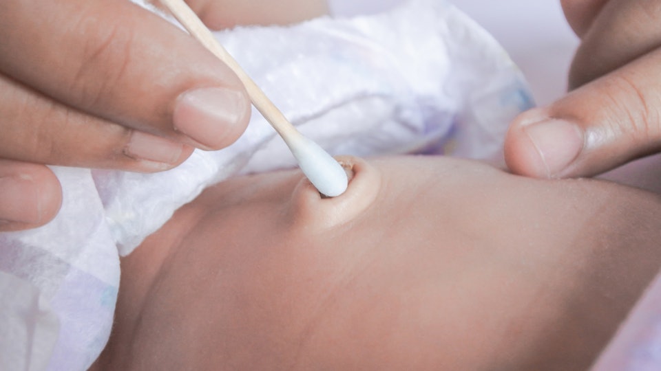 How To Remove Umbilical Crust From Your Baby S Belly Button