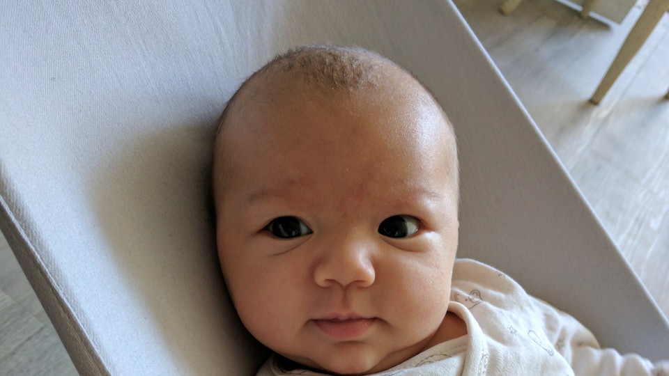 How To Remove Cradle Cap Because You Want To Do It Gently Safely