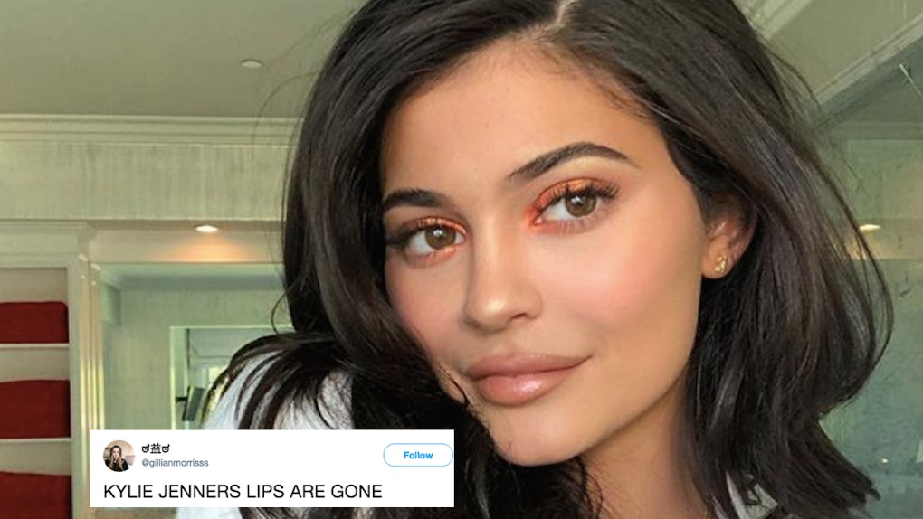 This Photo Of Kylie Jenner Without Lip Filler Has Fans So Surprised