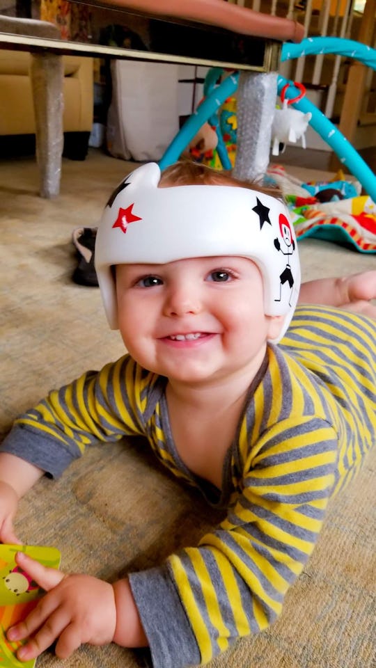 My Son Has To Wear A Helmet & It’s NBD