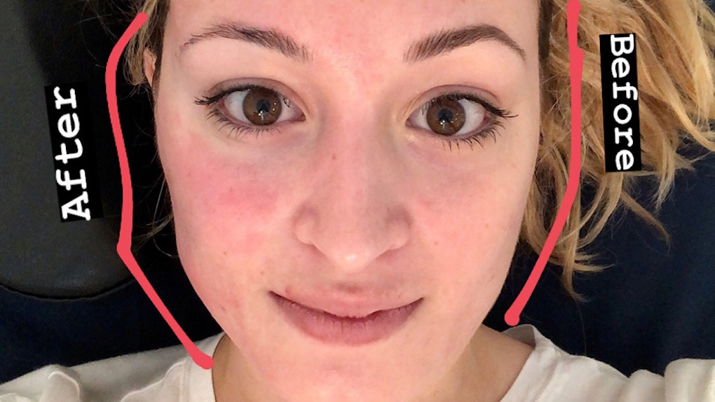 I Tried The Forma Non Surgical Facelift It Completely Sculpted