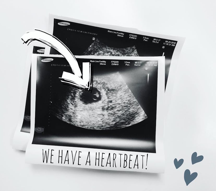 Dese'Rae L. Stages' baby ultrasound image