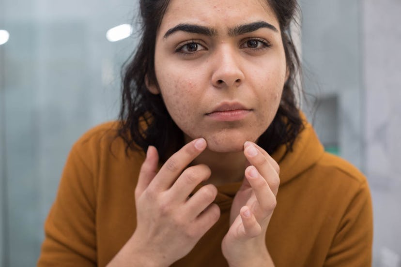 A woman wearing a brown hoodie looks in the mirror and checks the acne on her chin