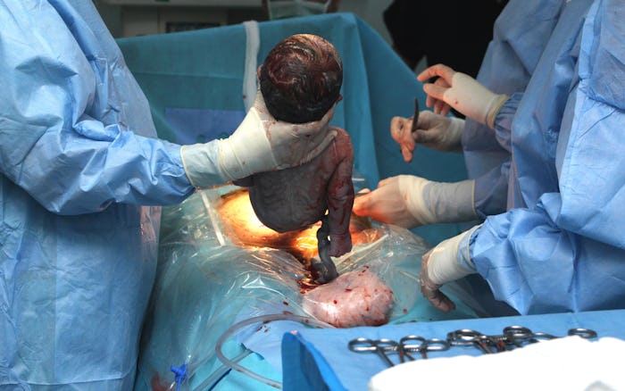 An OB-GYN delivering a baby during childbirth in a hospital room with two assistants