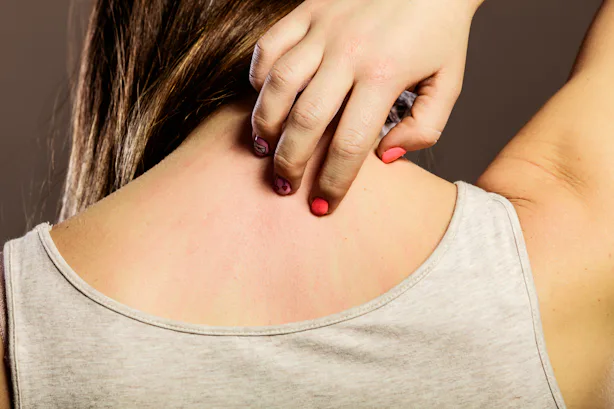 What's Causing Your Skin Rash? The Culprit Might Not Be As Obvious As ...