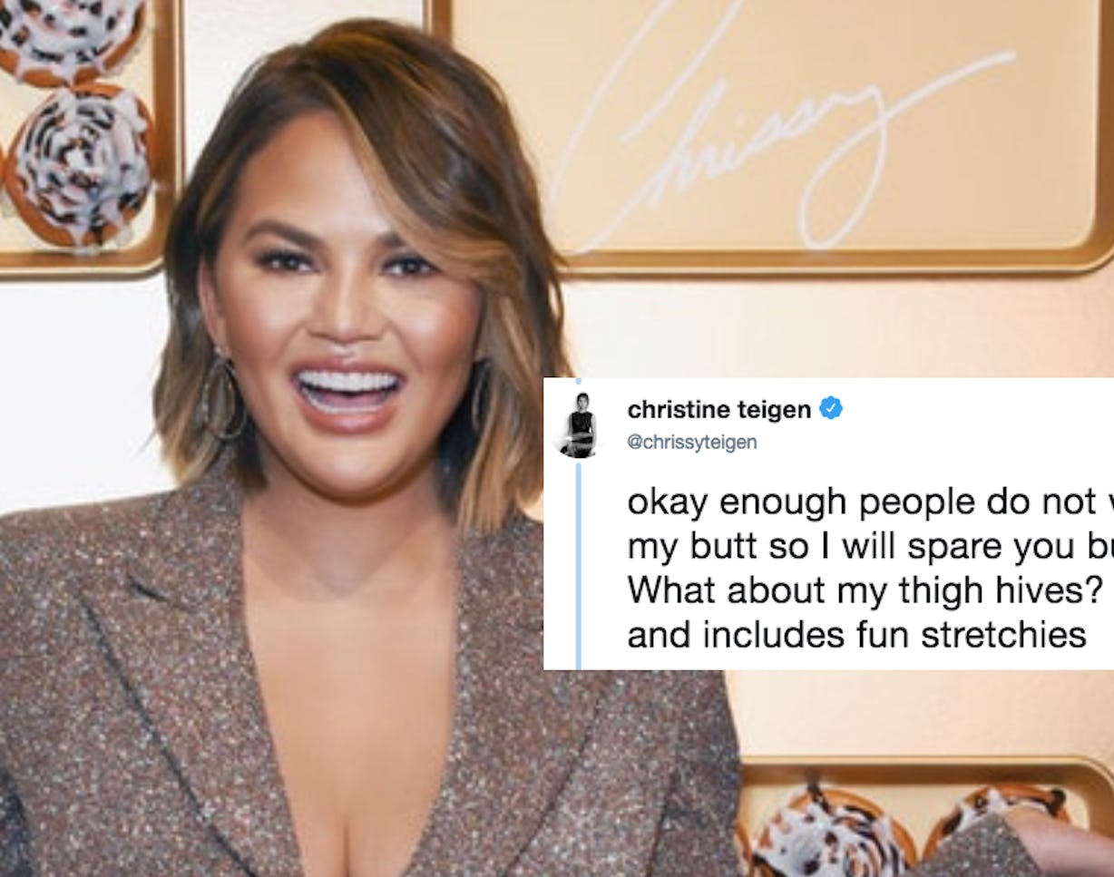 Chrissy Teigen's Photo Of Her "Fun" Stretch Marks & "Thigh Hives" Is