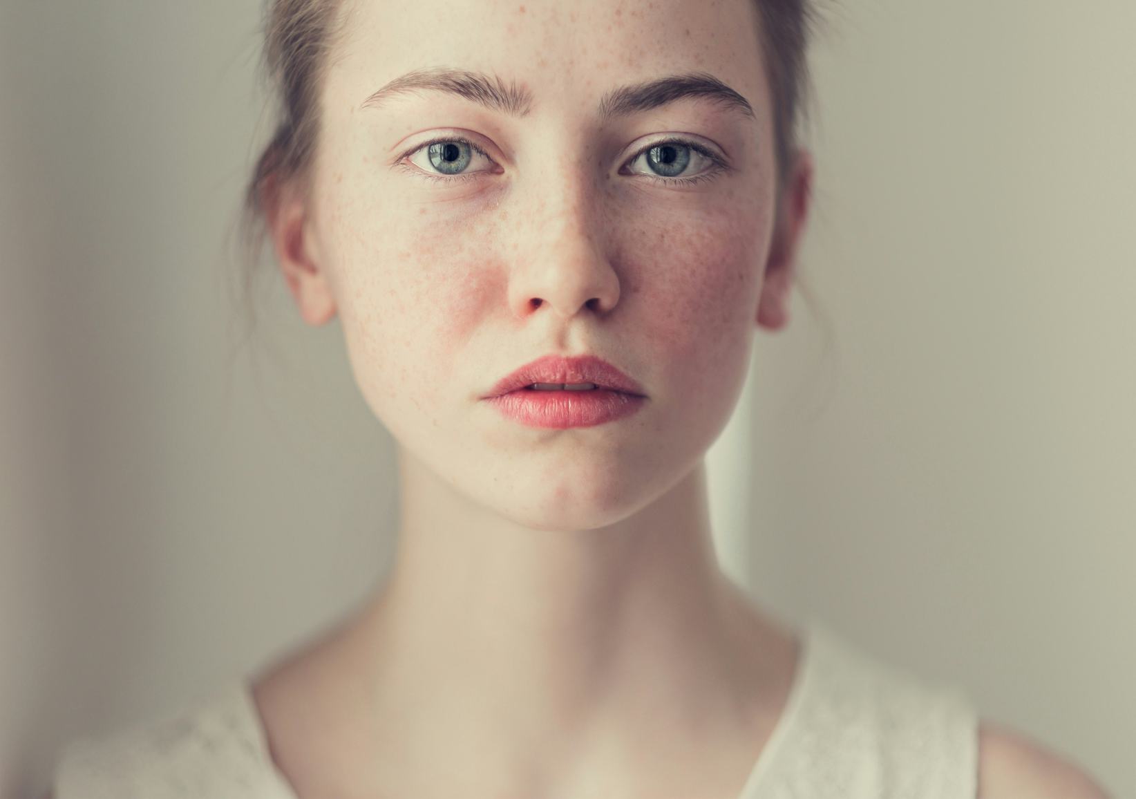 9 Things Your Skin Can Tell You About Your Health