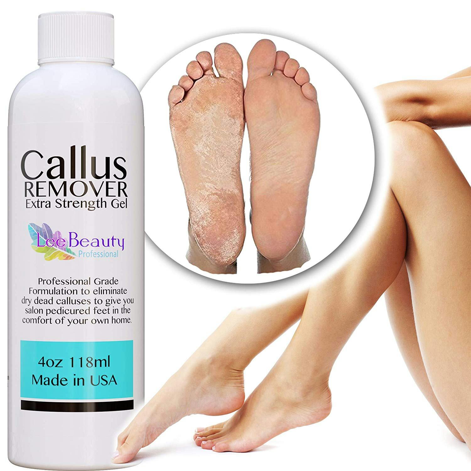 The 7 Best Callus Removers