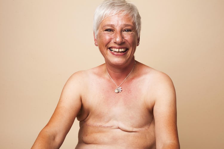 breast cancer awareness month confident caucasian woman double mastectomy scars 