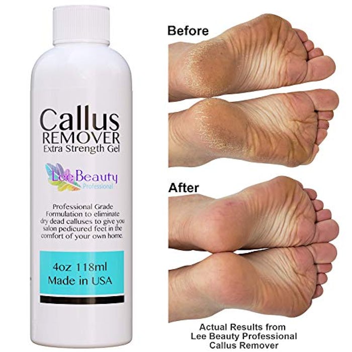  Lee Beauty Professional Callus Remover gel for feet