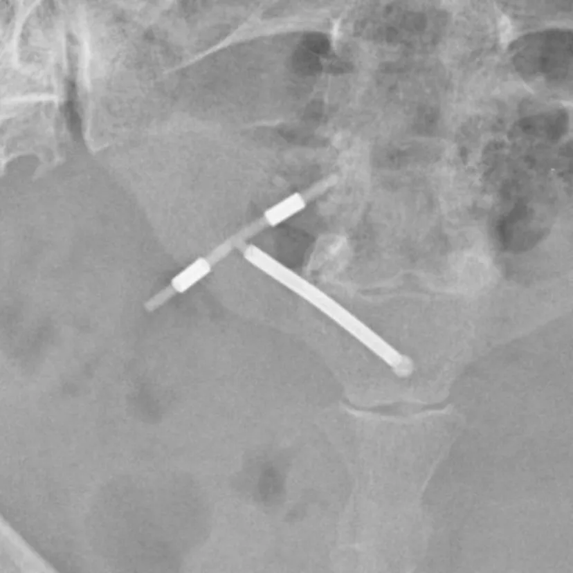 iud and smoking cigarettes Vaping birth control: Too risky to go together Does Smoking Affect Women's Hormones?
